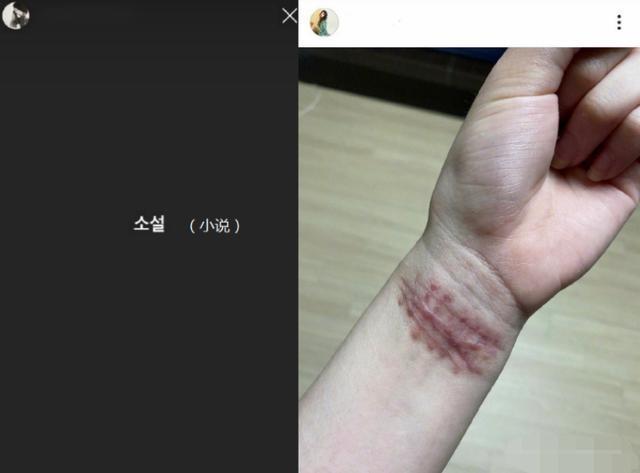 AOA成员曝被霸凌，曾割腕自杀：揭开韩国“女团恩怨”的遮羞布