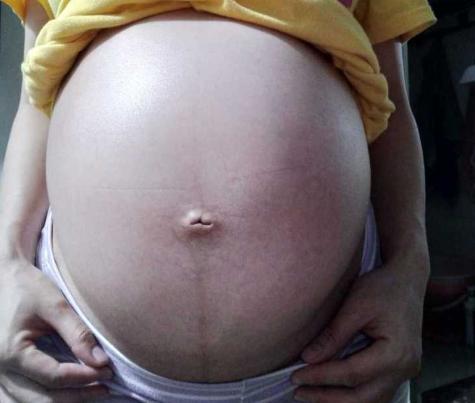 早孕孕吐不当回事，胚胎在宫内被排斥，太粗略