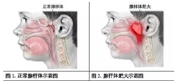 4岁宝宝打呼噜，宝妈感觉不正常，带儿子去医院，检查完妈妈大哭