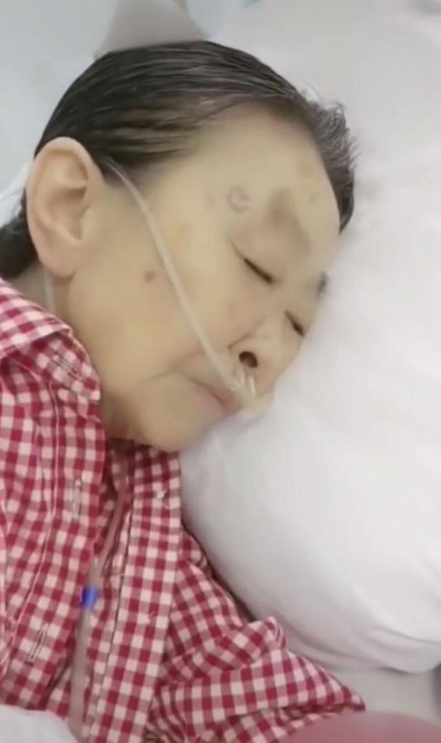 83岁"丑娘"张少华被曝孤身一人住院，双鼻插管安静侧卧