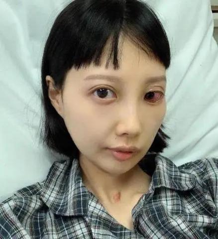 香港歌手李明蔚：抗癌治疗8年，靠血液续命，今放弃治疗等待死亡