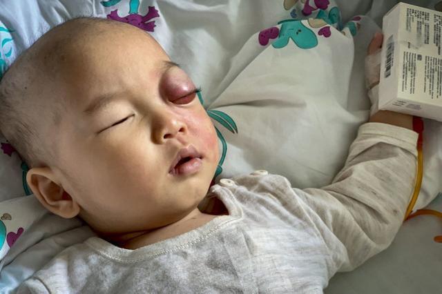 广西一男婴出生37天双眼有如“玻璃珠”，检查结果出来父母傻眼了