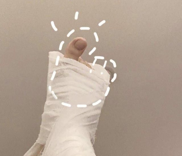 R1SE刘也练舞意外崴脚，打石膏向粉丝报平安，还不忘卖萌