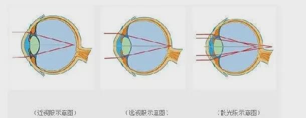 都在嘲杨超越的脸像充了气，谁注意到她眼里透露出的求救信号？