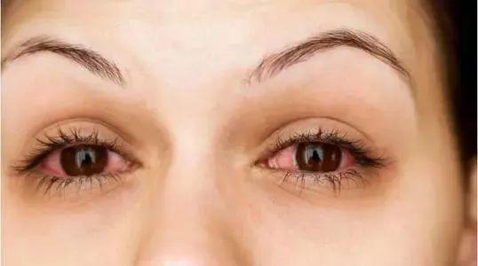 (模拟图:吸食大麻的眼睛)