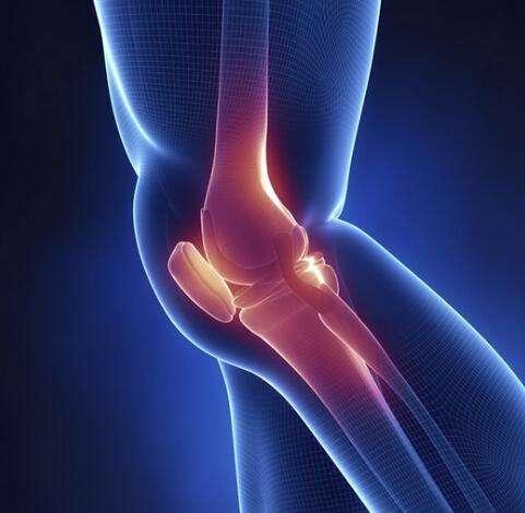 膝盖疼痛、膝关节难抬？骨科专家教你护理，滑膜炎、积液慢慢流走