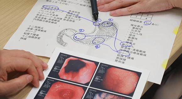 医生讲解胃镜的诊断结果