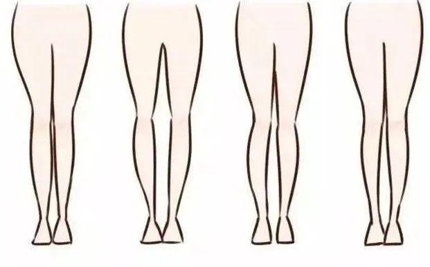 理想的腿 / O型腿 / X型腿 / XO型腿