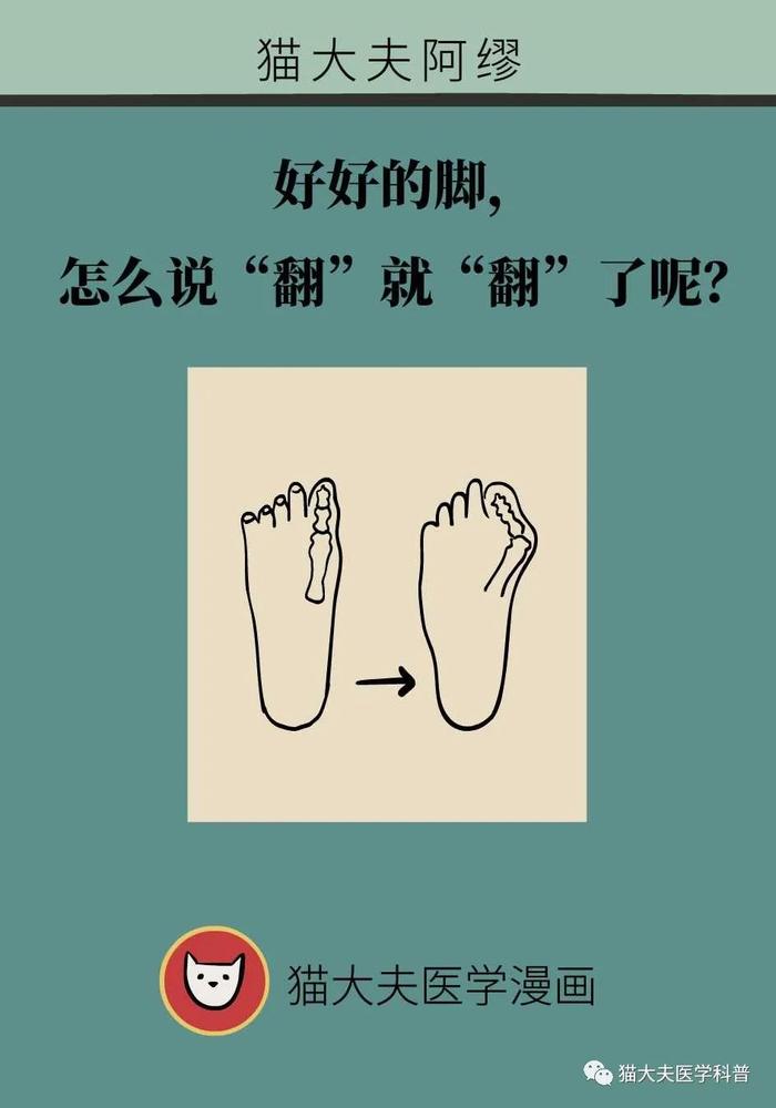 好好的脚，怎么说“翻”就“翻”了呢？