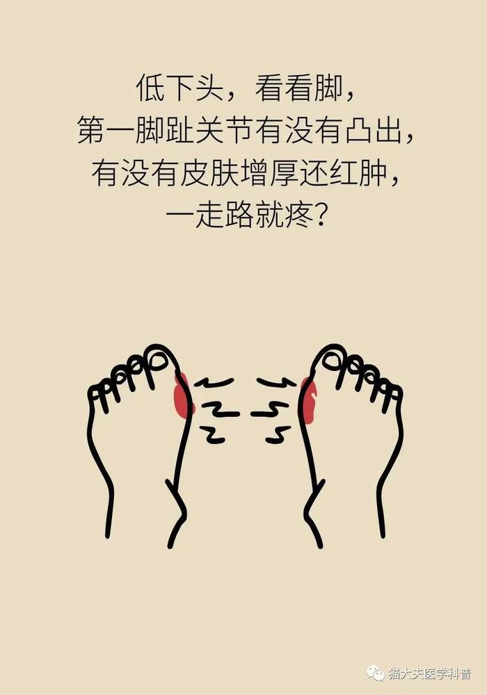 好好的脚，怎么说“翻”就“翻”了呢？