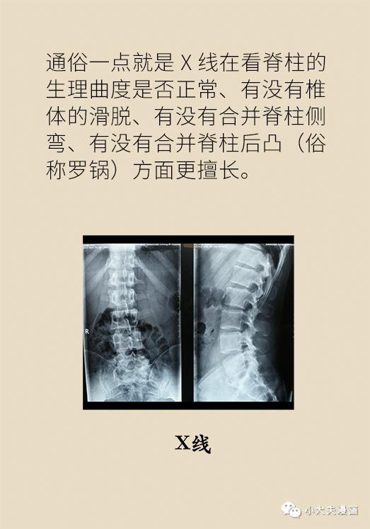 腰痛用不用去医院？协和医生教你在家自查