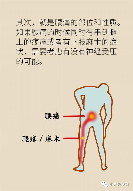 腰痛用不用去医院？协和医生教你在家自查