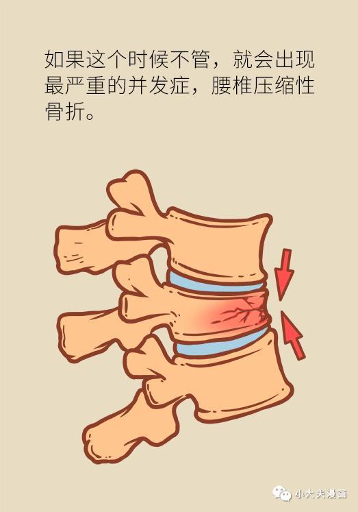 预防骨质疏松引起的可怕并发症，光靠补钙可不够