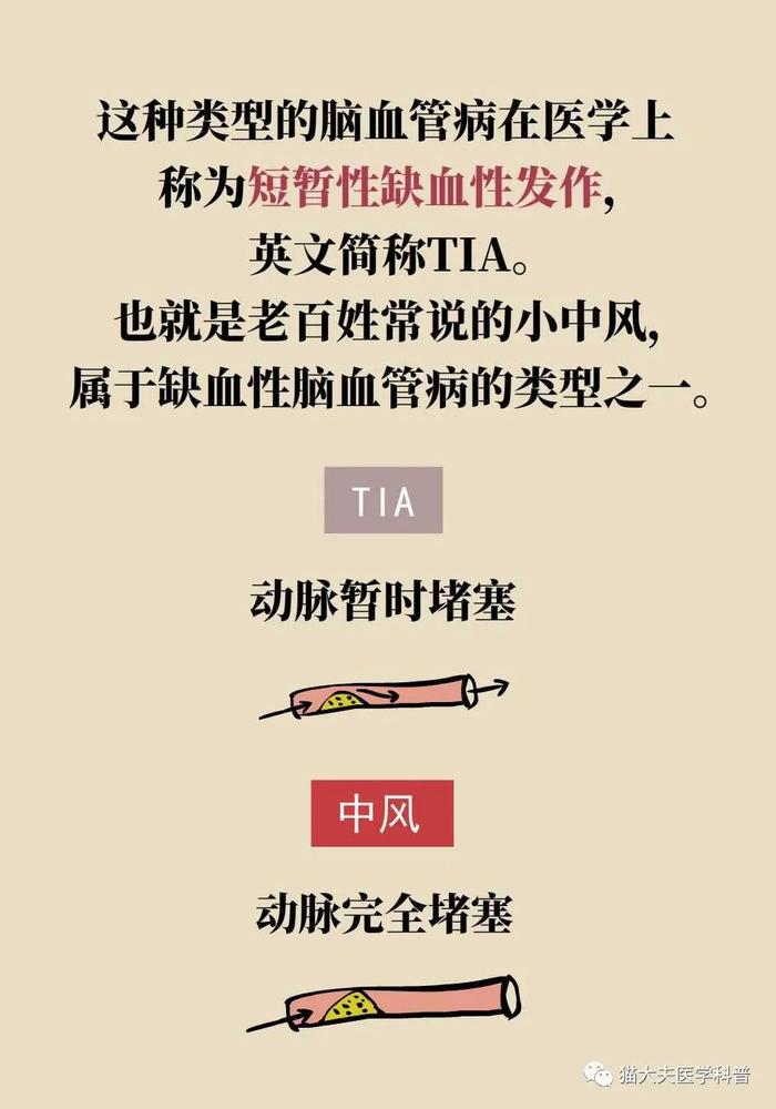 脑梗死、脑出血、脑卒中、脑中风，是不是一回事？