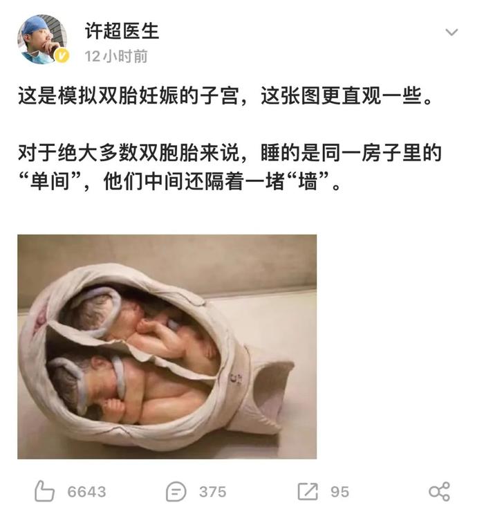 双胞胎在娘胎里打架出生后浑身淤青？你又被骗了