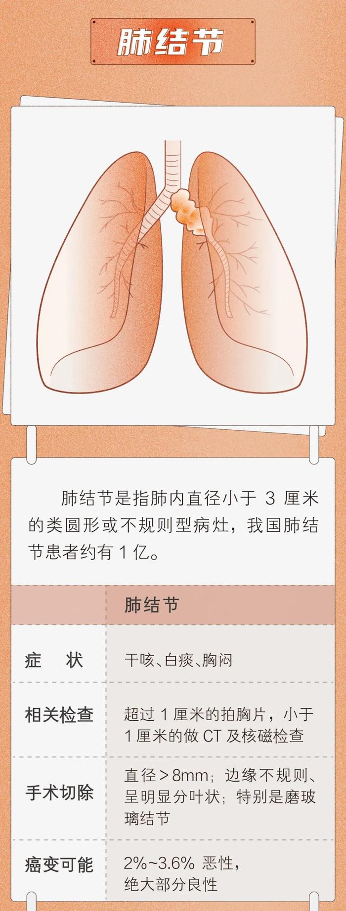 乳腺结节、甲状腺结节、肺结节……体检中最普遍的3种结节，如何判断良恶性？