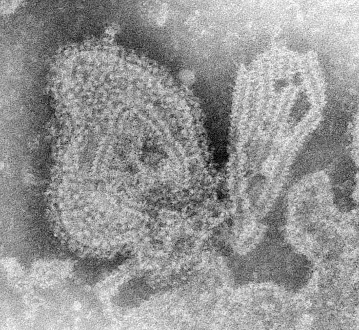 腮腺炎病毒(图源:CDC)