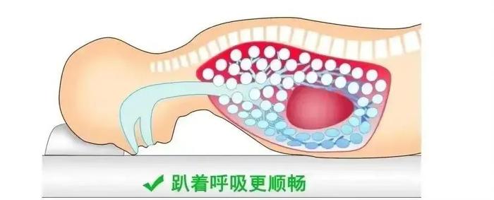 科普｜得了新冠胸闷不舒服，俯卧位通气如何操作？华山感染详解