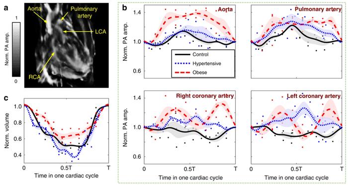 图丨健康、高血压和肥胖大鼠心血管血流动力学比较(来源:Light: Science & Applications)