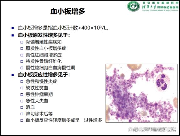 垂医科普 | 血常规：小检查，大作用