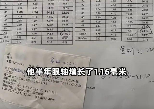 1岁娃近视600度上热搜！近视会遗传？医生说……