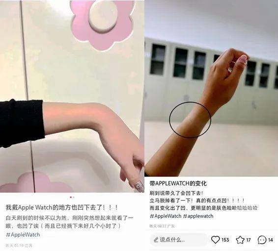 多人网曝戴苹果手表“手凹了”？还有人出现疼痛症状...