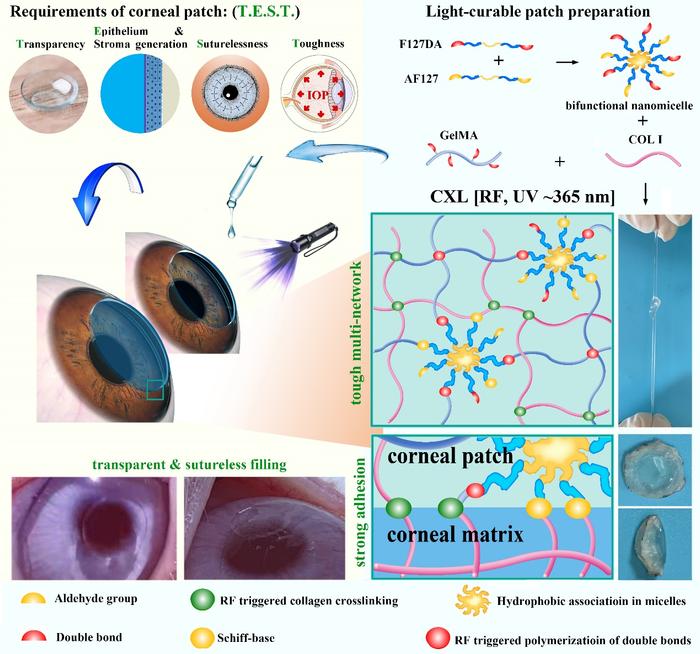 上海市五官科医院最新研究：新型光固化水凝胶可促进角膜修复