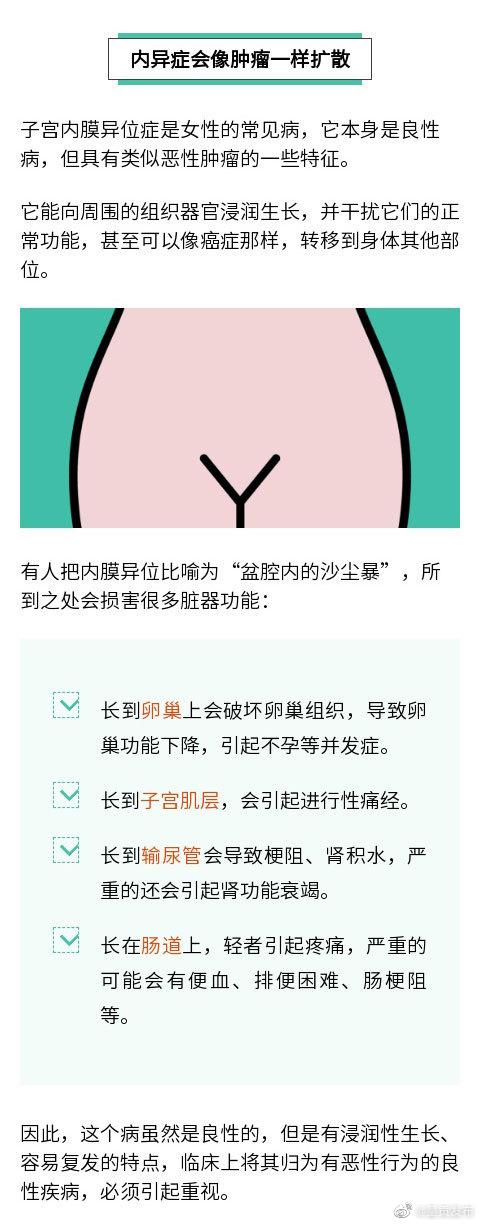 什么是巧克力囊肿？这种妇科病会像癌一样扩散