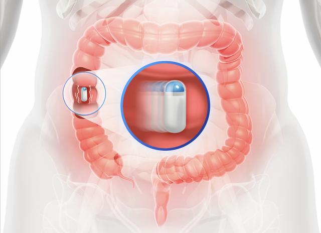 中国便秘日｜高科技消化道振动胶囊：便秘的现代解决方案
