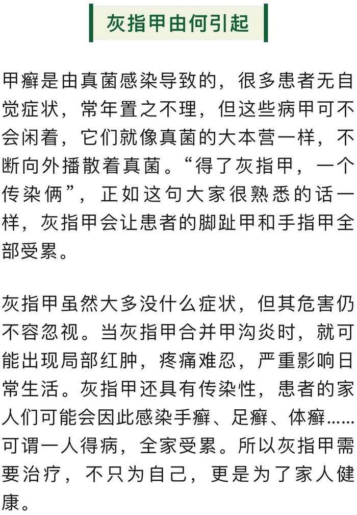 网络辟谣：灰指甲不痛不痒，不治可以吗？