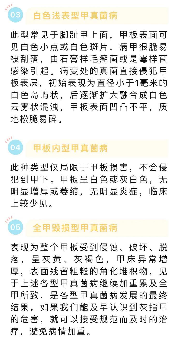 网络辟谣：灰指甲不痛不痒，不治可以吗？