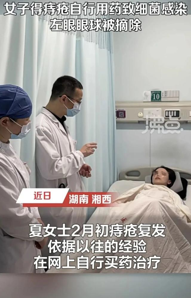 一女子自行用药治痔疮，导致眼球被摘除！