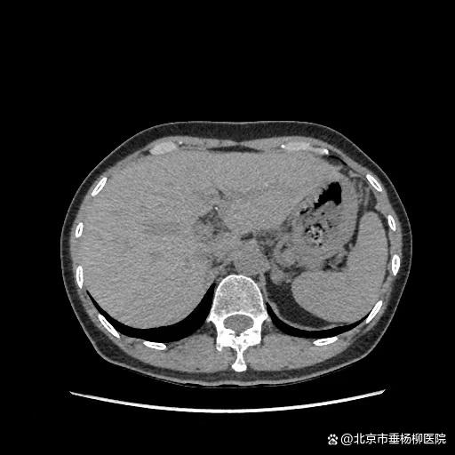 院庆50周年系列科普 | 消化内科医生提醒：红枣粽子好吃，一定要细嚼慢咽