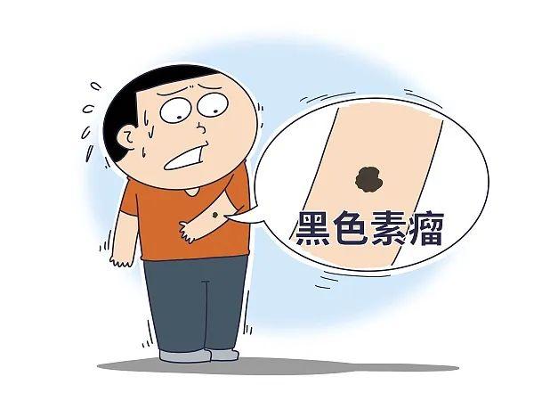 “科学”流言｜身上的痣都要切掉，不然会发展成黑色素瘤？