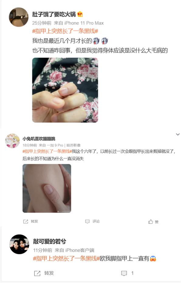 指甲上突然长了一条…上热搜！网友慌了