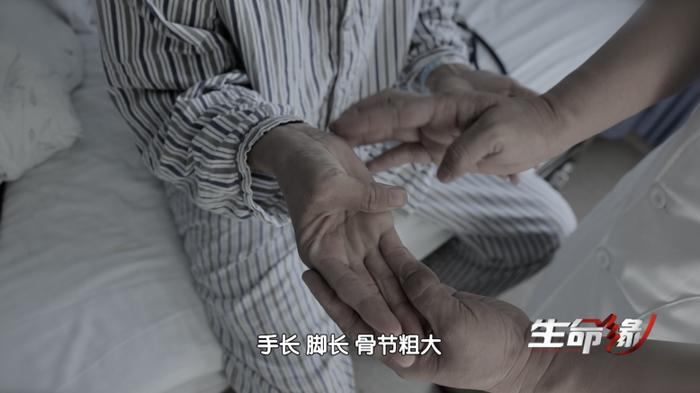 《生命缘》 | 主动脉夹层的高危因素是这种常见病