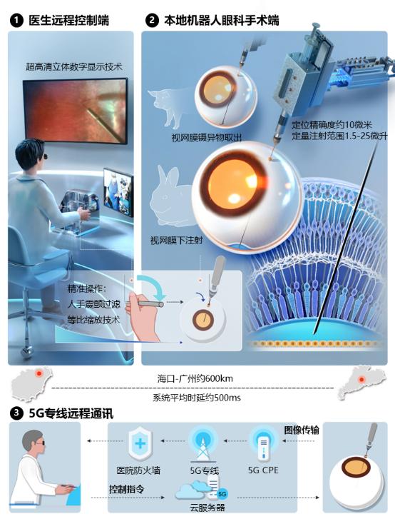 全球首例！中山大学跨越琼州海峡开展5G远程微米级眼科手术