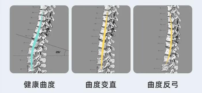 久坐提醒、坐姿监测，人体工学坐垫解救职场老腰