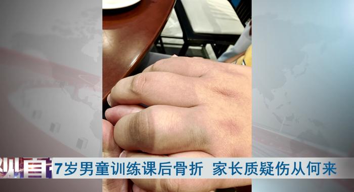 武汉7岁男童上完训练课后意外骨折！孩子：老师弄的…家长怒了！