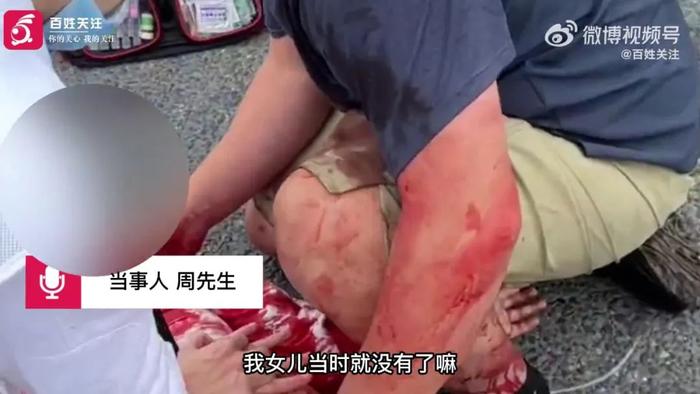 连环悲剧！儿子被撞，送医途中出车祸致女儿身亡……