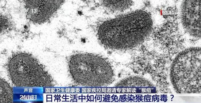 猴痘9月20日起纳入乙类传染病管理，政策解读