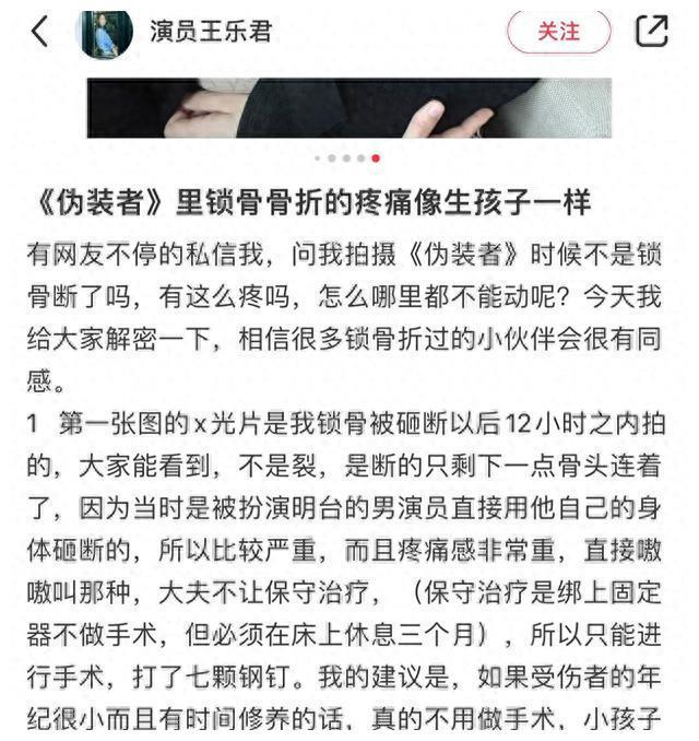 女星悲愤称被胡歌砸断锁骨!住院照曝光引发网友热议
