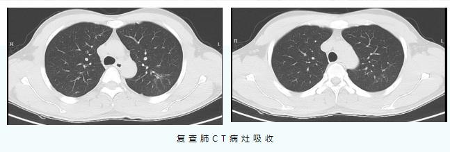 一家3口全部感染！有人肺部出现大片炎症……提醒！