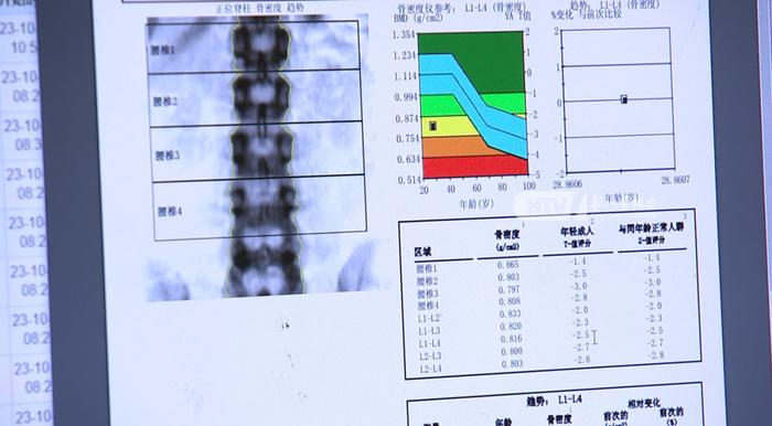 女子每天3杯咖啡，连喝30年……查出这种病！医生提醒