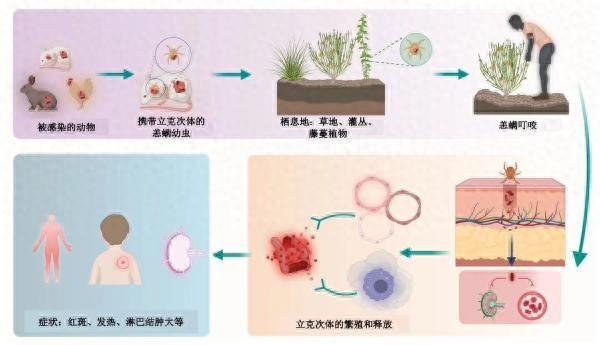 郊游后全身红疹高烧难退，医生提醒：近期气温偏高小心恙虫病