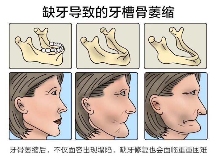 别再拖着了！有这些症状的人要注意了...