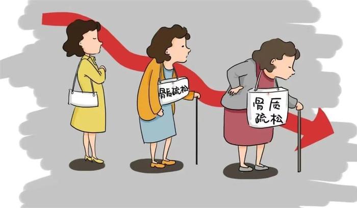 预防骨质疏松，补钙就可以了吗？｜科普时间