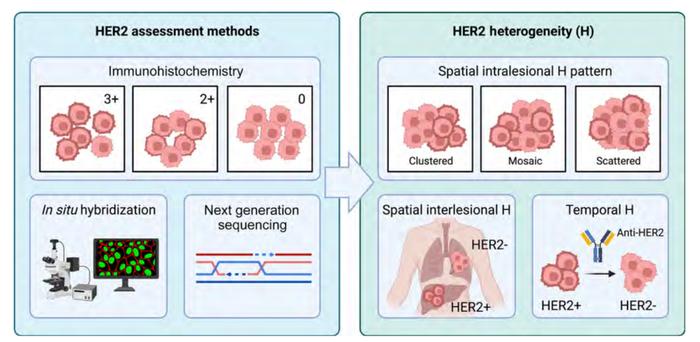 HER2阳性乳腺癌的HER2异质性及其临床意义