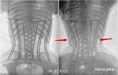 知名演员接连求助，处理方法却引争议！此前有女星因此进医院