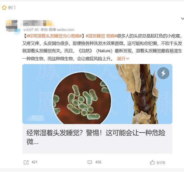 经常湿着头发睡觉，有什么危害？